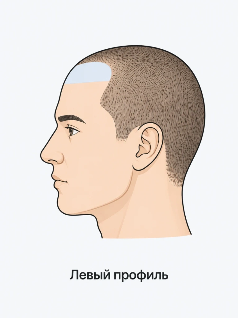 photo-left-profile.webp